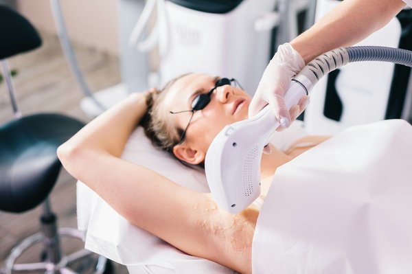 Pourquoi opter pour l'épilation définitive au laser des aisselles ?